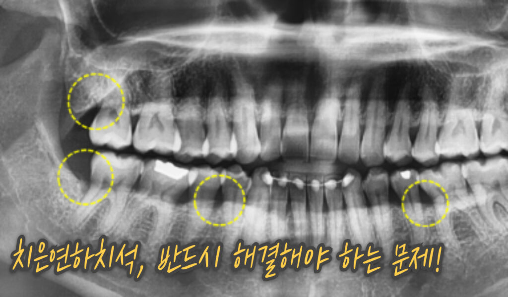 문제