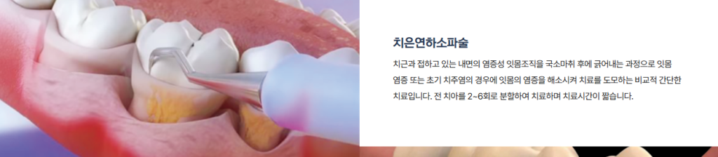 소파