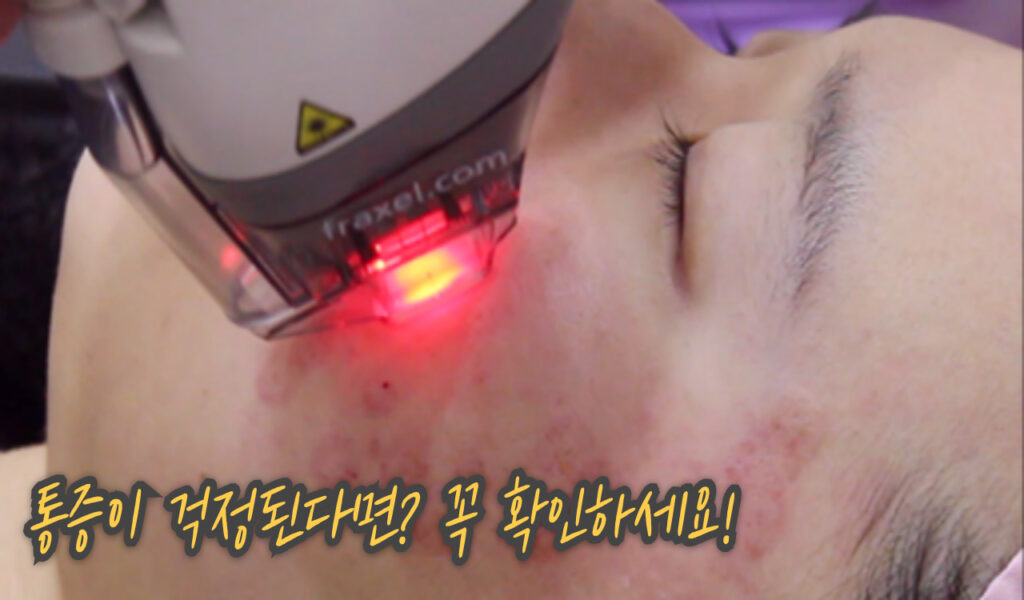 4만 8천원에 피부나이가 거꾸로? 40대 여성의 프락셀 비용 후기 6 통증걱정
